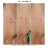 soin ciblé perfection la canopée résultat